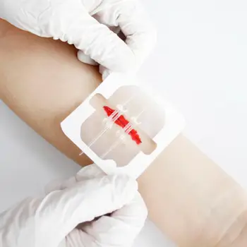 Reißverschluss Band-aid Schmerzlosen Wundverschluss Gerät Naht-Kostenlose Wunde Dressing Pflaster Zip-Naht Reducer Band Aid